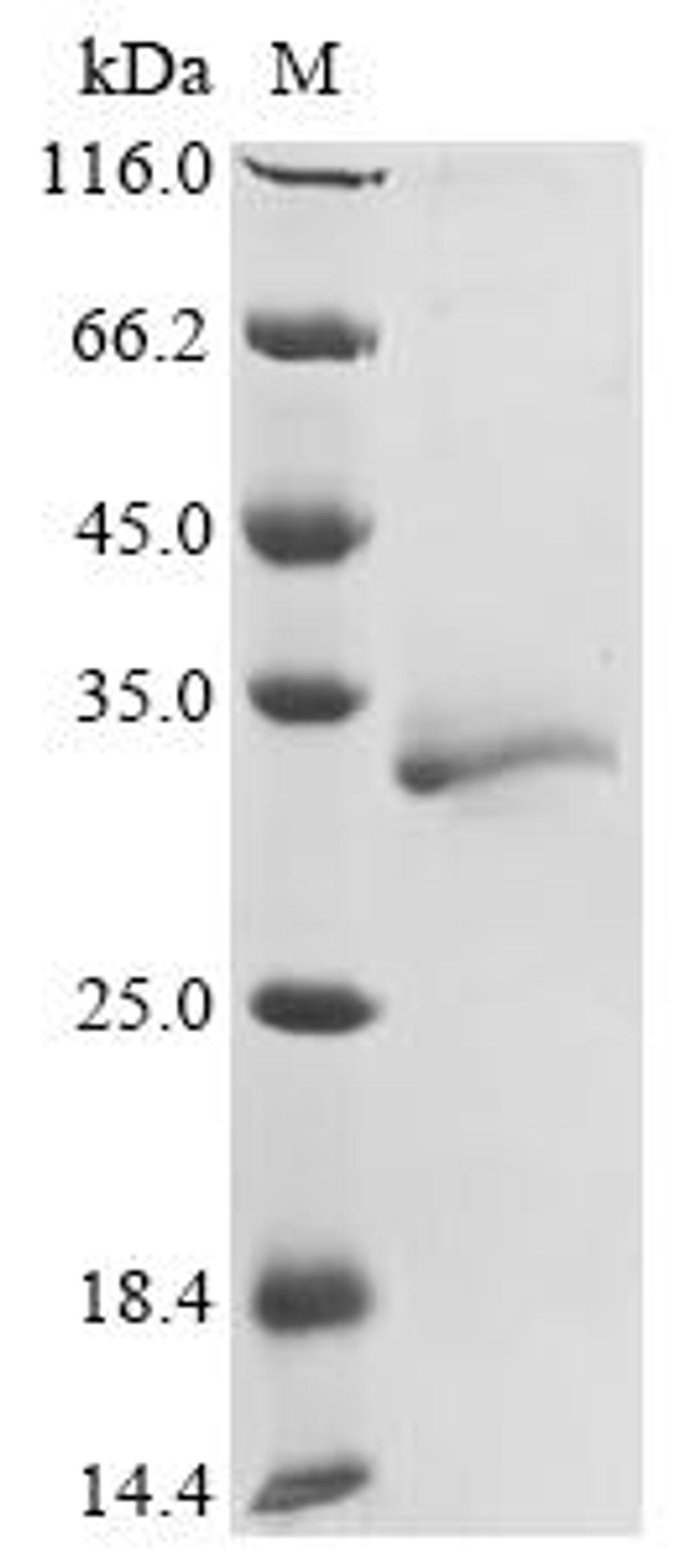 (Tris-Glycine gel) Discontinuous SDS-PAGE (reduced) with 5% enrichment gel and 15% separation gel.
