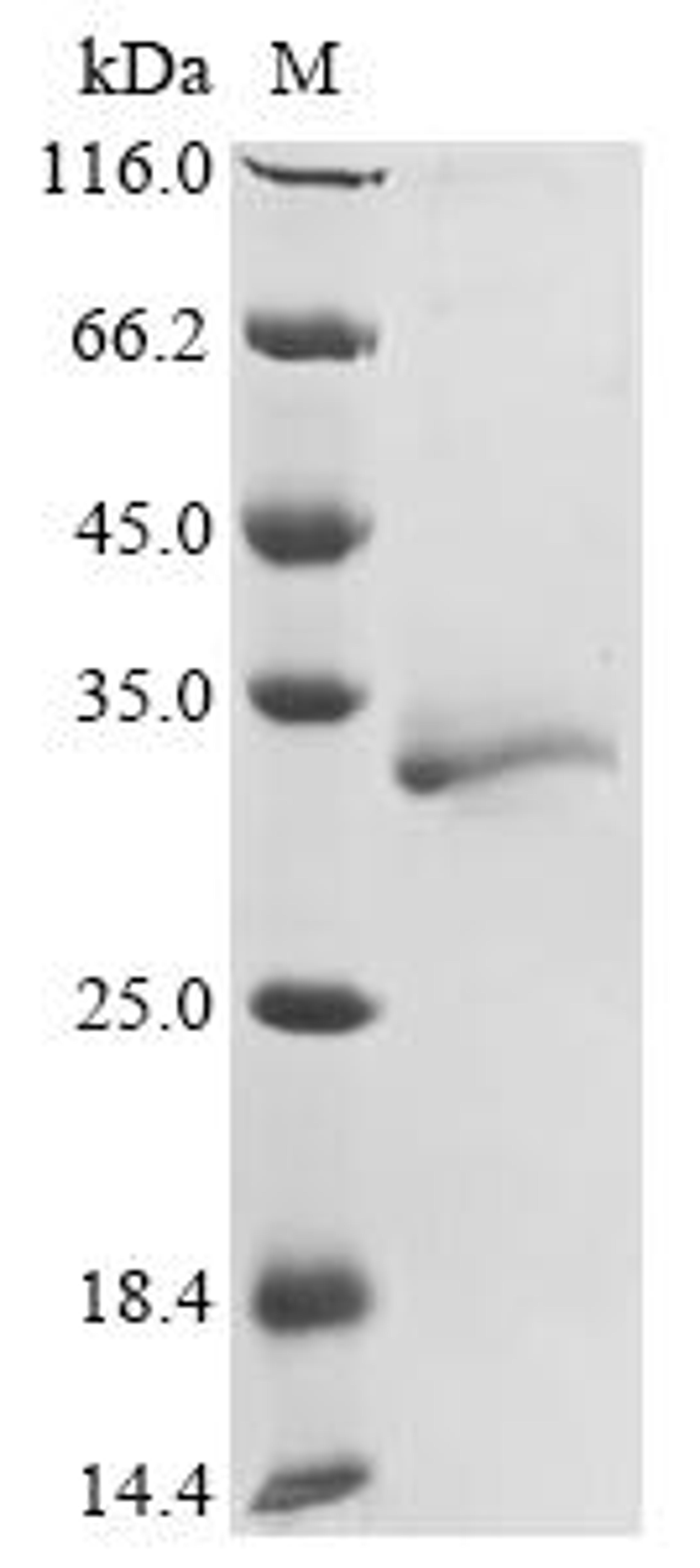(Tris-Glycine gel) Discontinuous SDS-PAGE (reduced) with 5% enrichment gel and 15% separation gel.