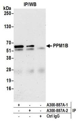 Detection of human PPM1B by western blot of immunoprecipitates.