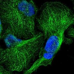 Immunocytochemistry/Immunofluorescence: CDC42EP2 Antibody [NBP1-88383] - Staining of human cell line U-2 OS shows positivity in cytoplasm & cytoskeleton (microtubules).