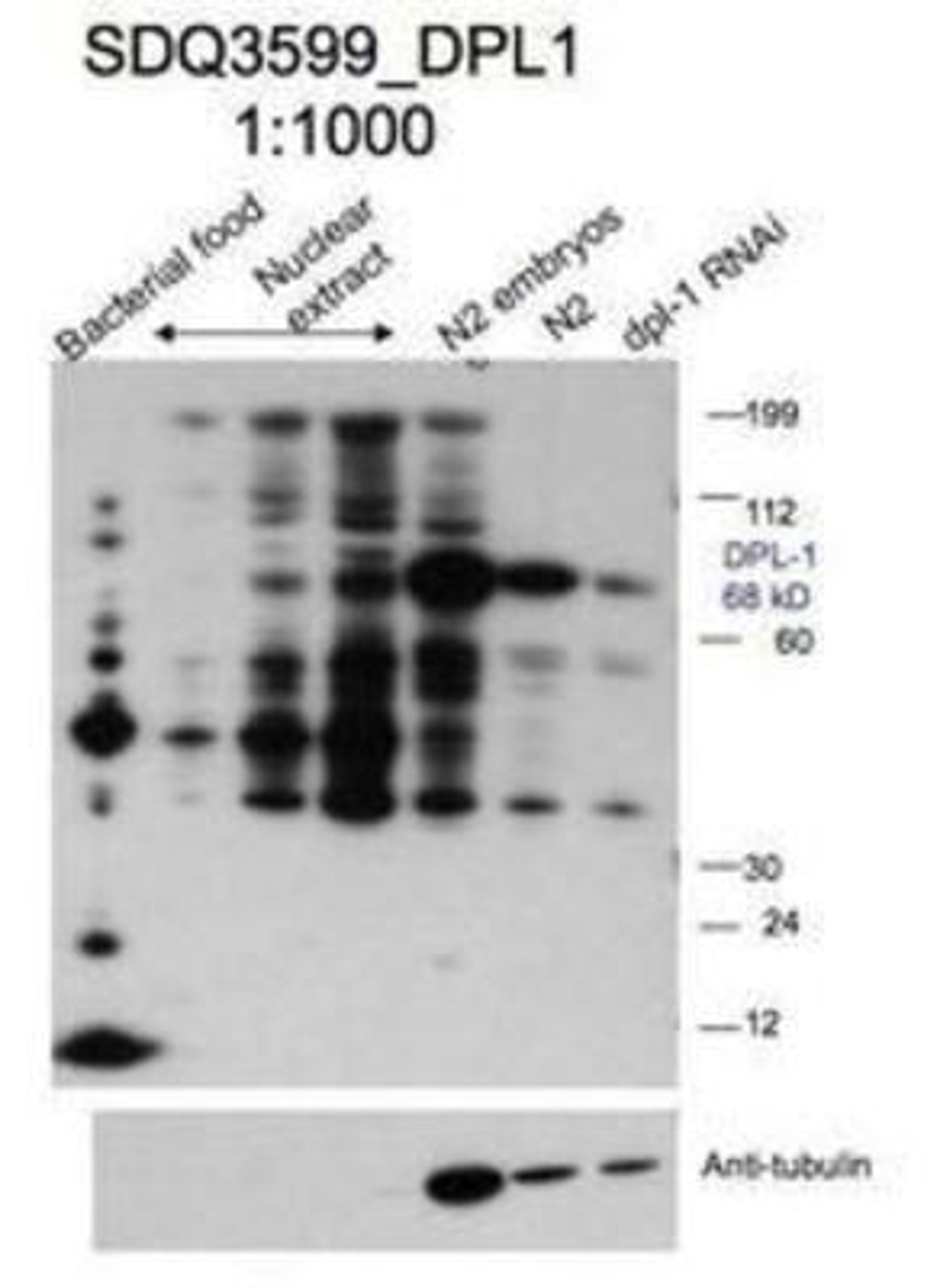 Western Blot: dpl-1 Antibody [44950002] - This image is specific to animal number SDQ3599 Dilution 1:1000