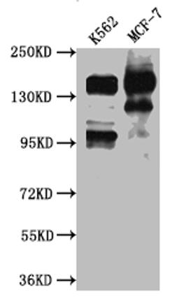 Western Blot. Positive WB detected in: K562 whole cell lysate, MCF-7 whole cell lysate. All lanes: mSin3A antibody at 1:1000. Secondary. Goat polyclonal to rabbit IgG at 1/50000 dilution. Predicted band size: 146 kDa. Observed band size: 146 kDa.