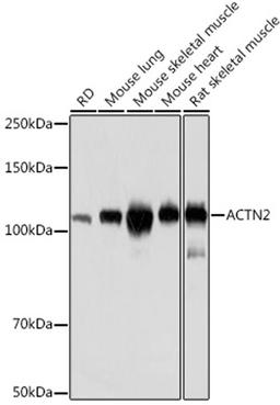 Western blot - ACTN2 Rabbit mAb (A8939)