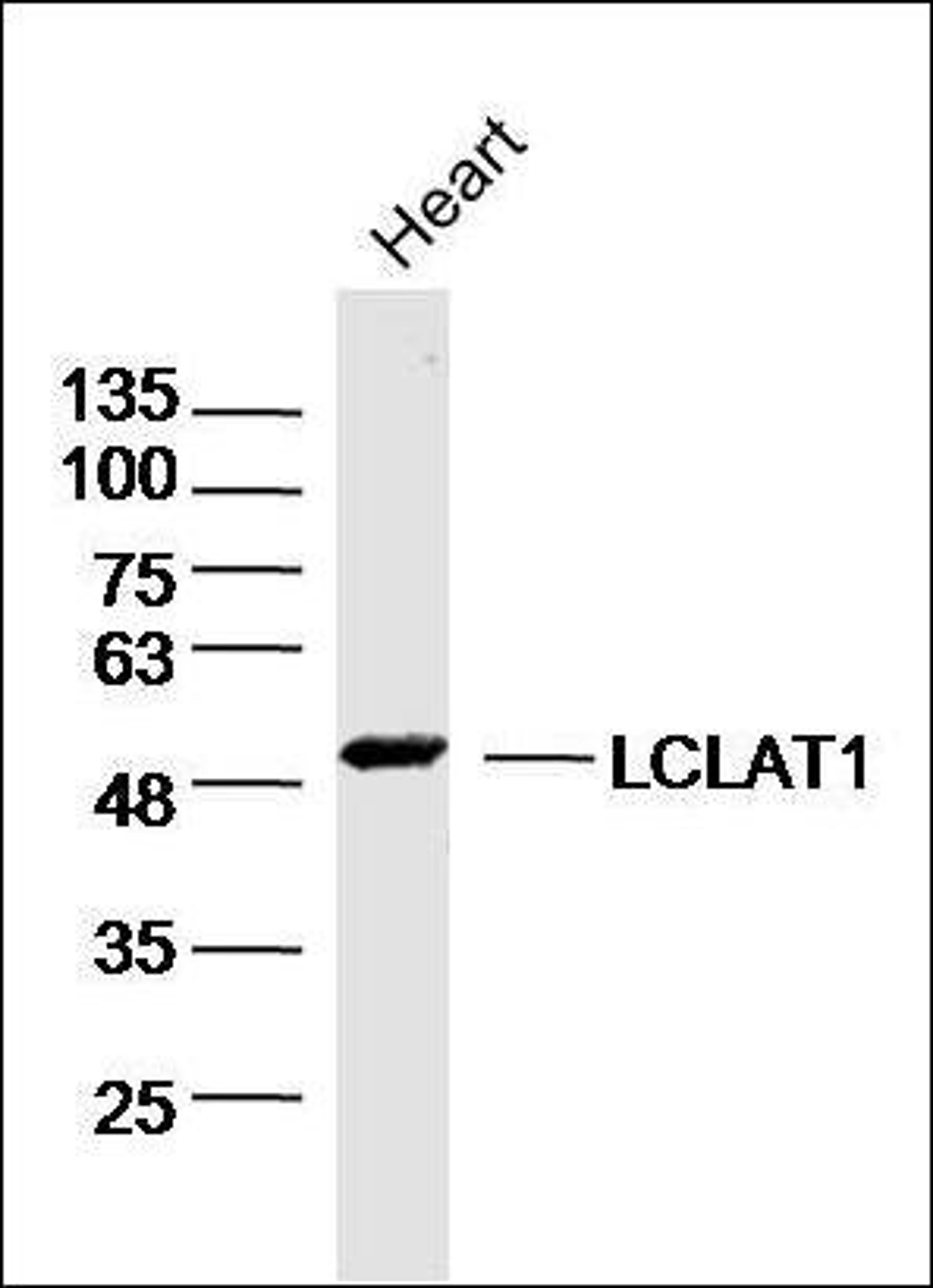 Western blot analysis of Mouse Heart Lysate using LCLAT1 antibody.