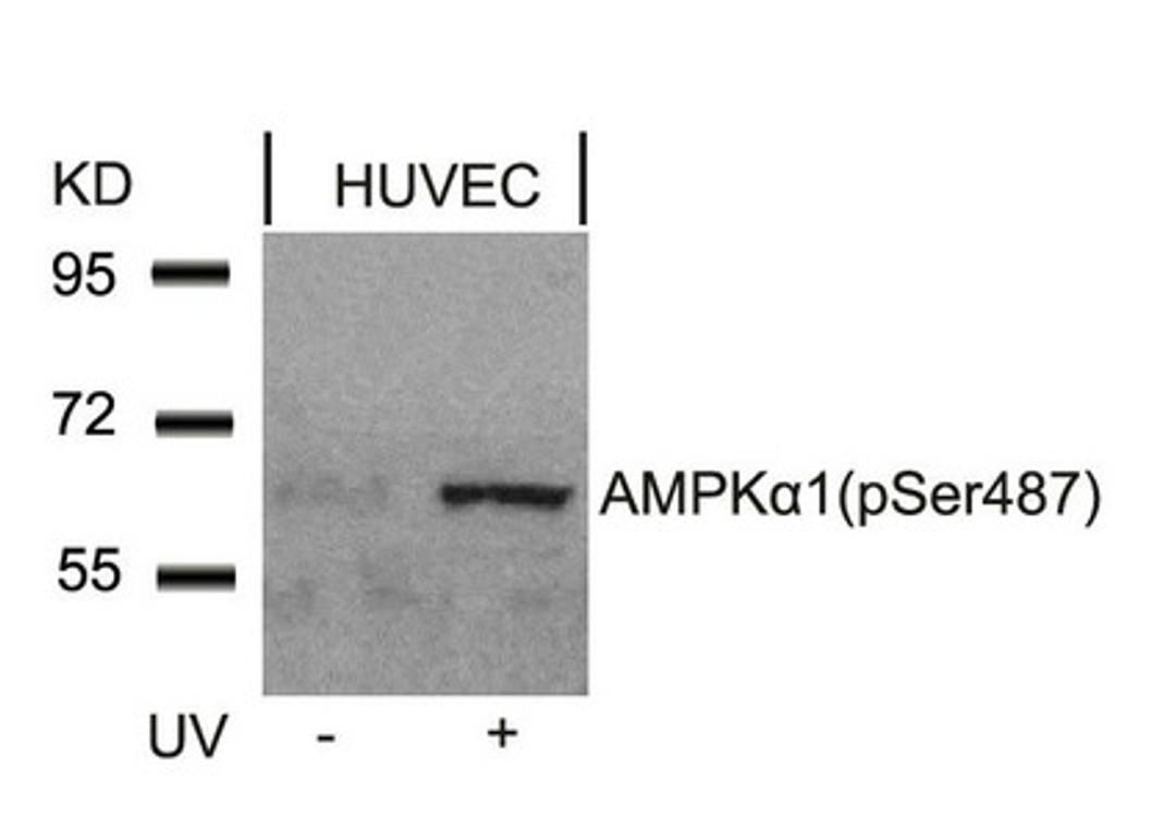 Western blot analysis of extracts from HUVEC cells untreated or treated with UV using AMPKa1(Phospho-Ser487)Antibody.