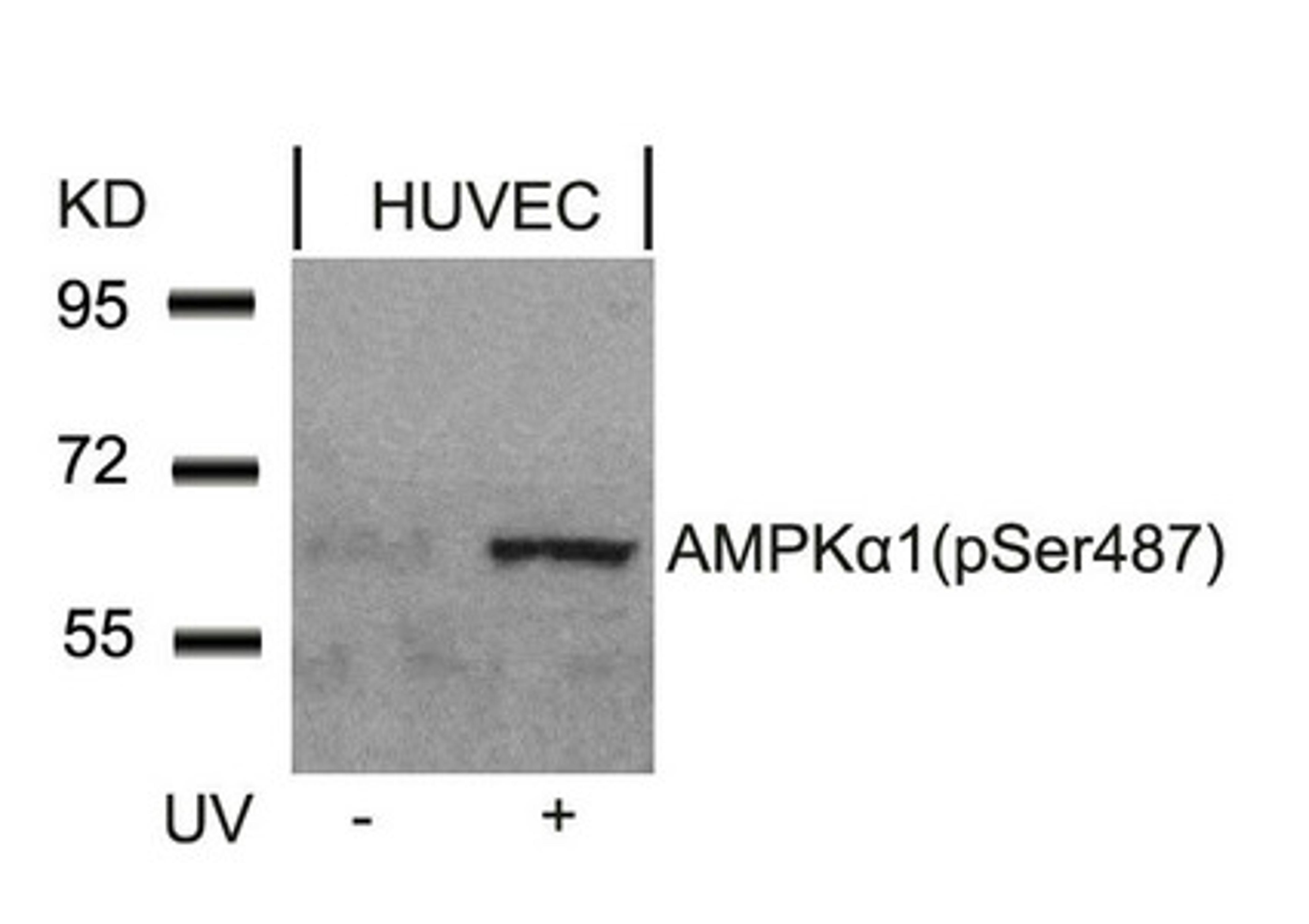 Western blot analysis of extracts from HUVEC cells untreated or treated with UV using AMPKa1(Phospho-Ser487)Antibody.