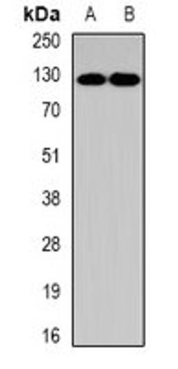 Western blot analysis of K562 (Lane1), NIH3T3 (Lane2) whole cell lysates using PUM1 antibody