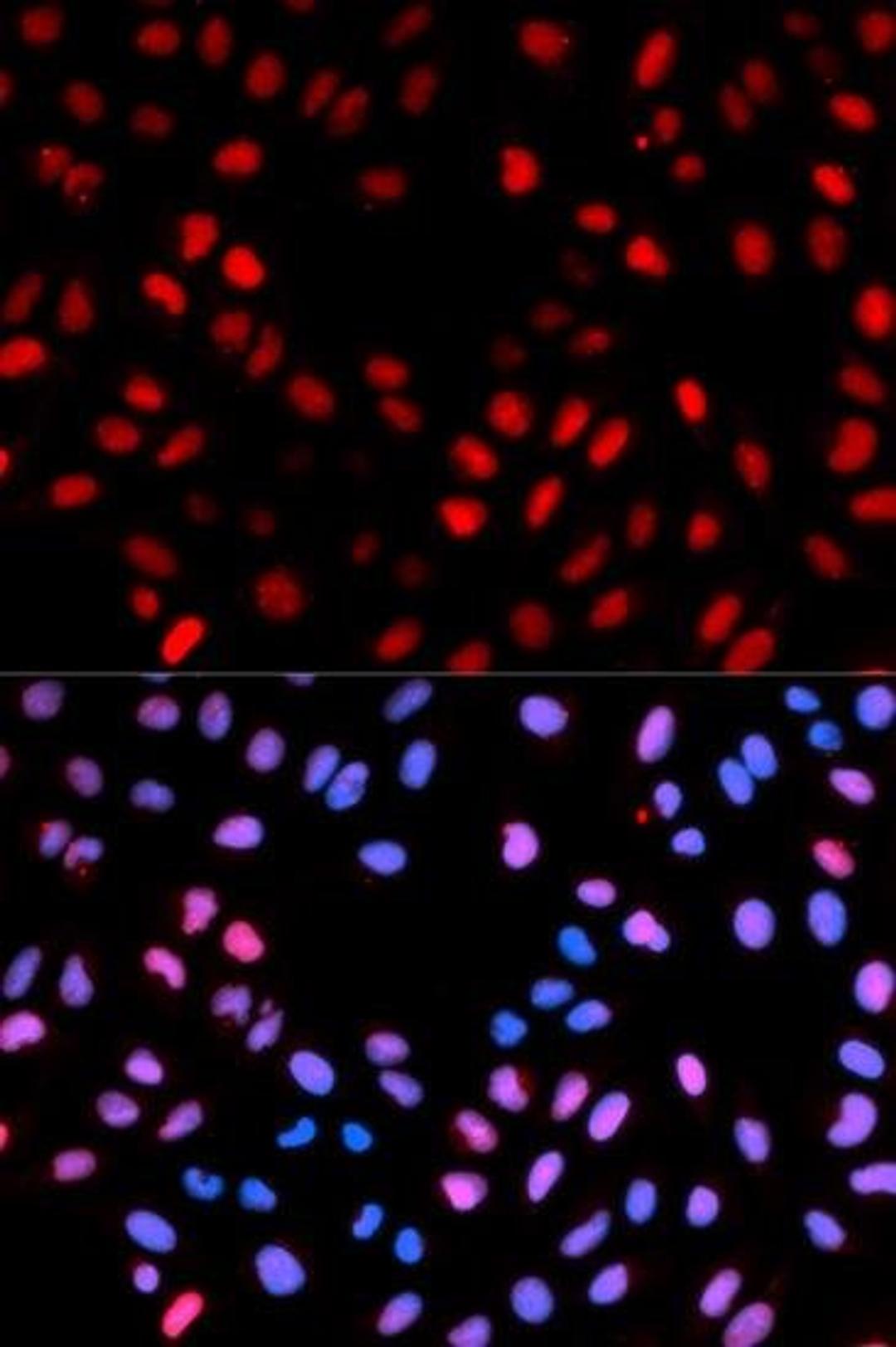 Immunofluorescence analysis of U2OS cell using RAF1 (phospho-Ser621) antibody