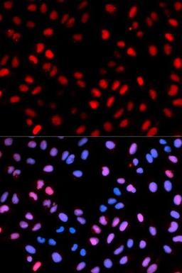 Immunofluorescence analysis of U2OS cell using RAF1 (phospho-Ser621) antibody