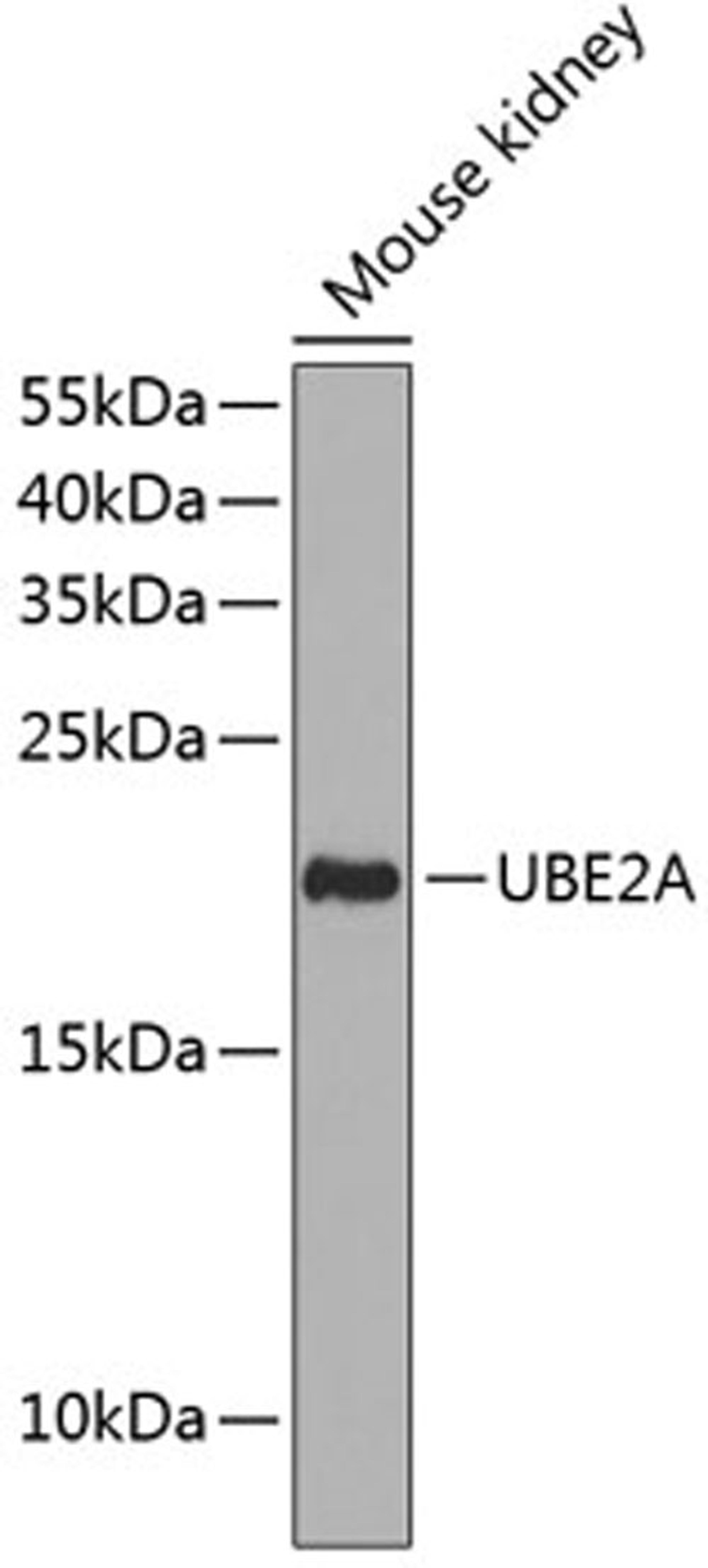 Western blot - UBE2A antibody (A12528)