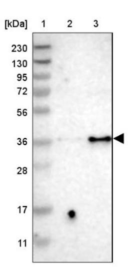 Western Blot: P2Y12 Antibody [NBP2-33870] - Lane 1: Marker [kDa] 230, 130, 95, 72, 56, 36, 28, 17, 11<br/>Lane 2: Human cell line RT-4<br/>Lane 3: Human cell line U-251MG sp