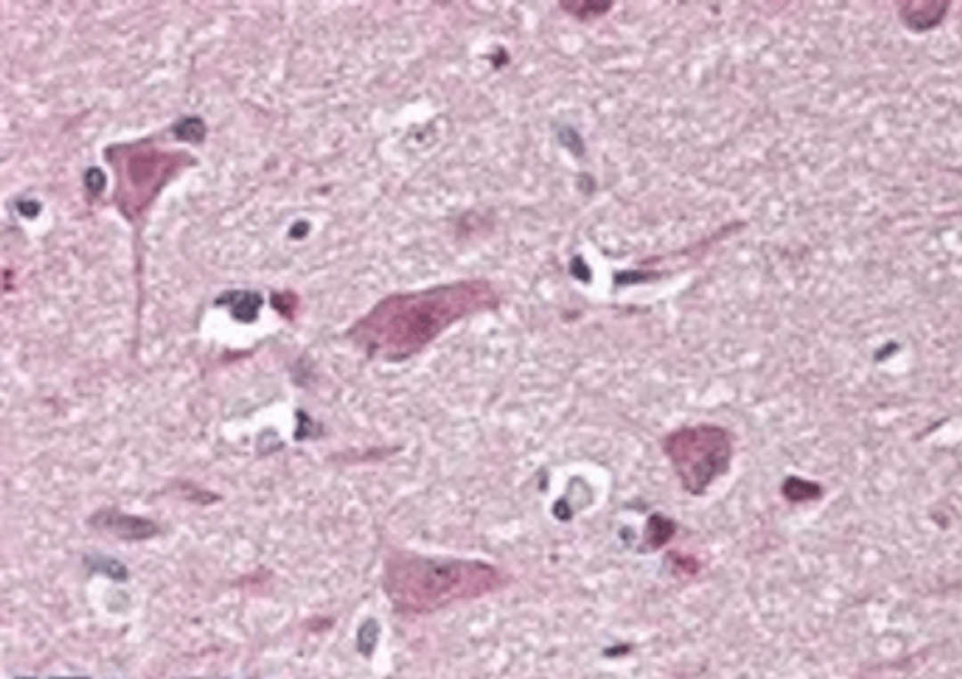 Immunohistochemical staining of Human Cortex using CHD7 antibody.