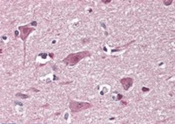 Immunohistochemical staining of Human Cortex using CHD7 antibody.