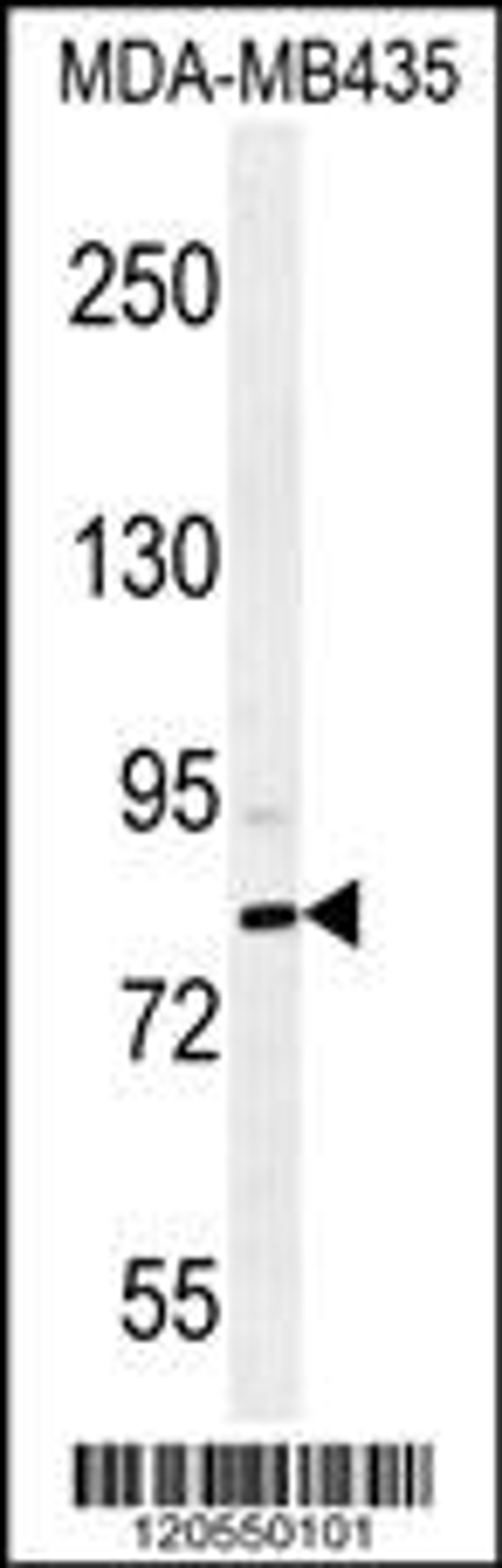 Western blot analysis in MDA-MB435 cell line lysates (35ug/lane).