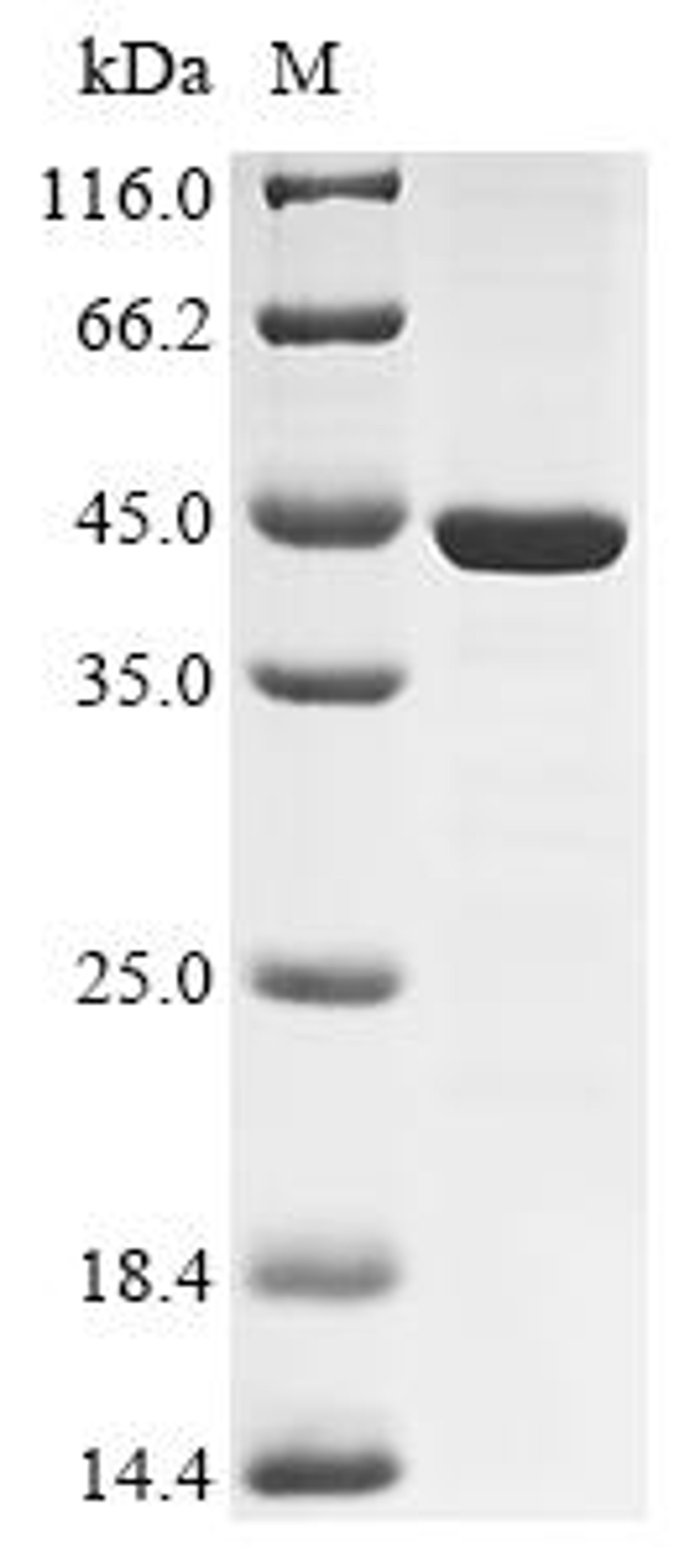 (Tris-Glycine gel) Discontinuous SDS-PAGE (reduced) with 5% enrichment gel and 15% separation gel.