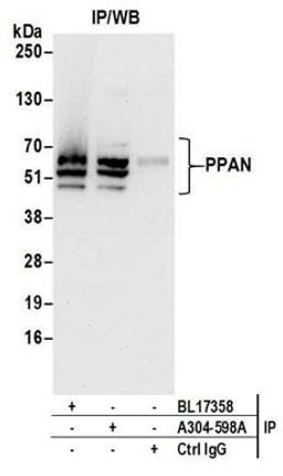 Detection of human PPAN by western blot of immunoprecipitates.