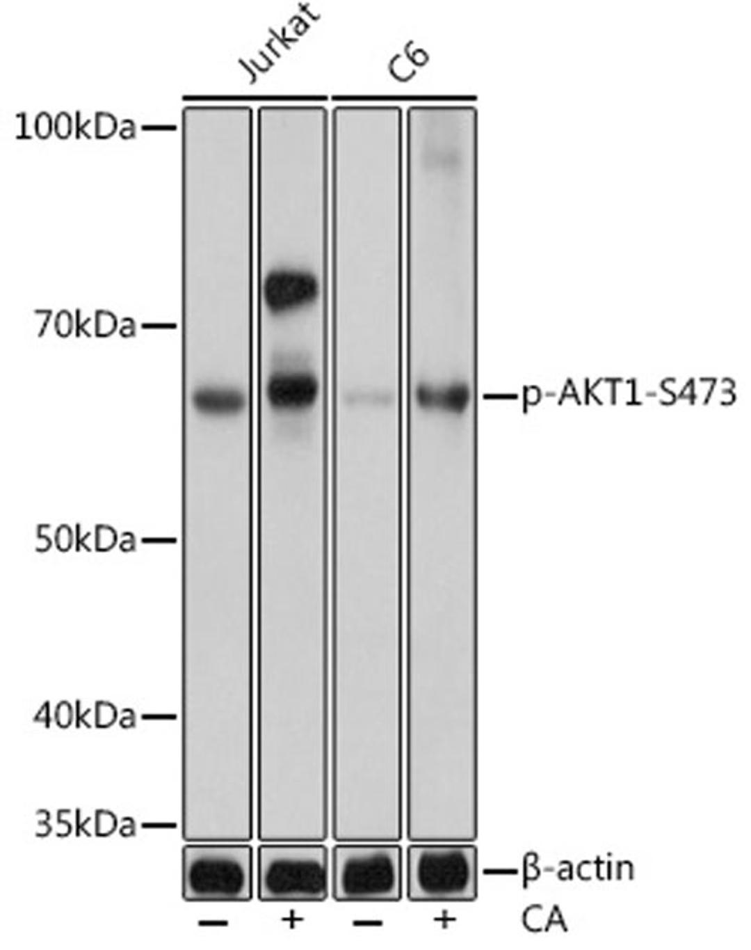 Western blot - Phospho-AKT1-S473 pAb (AP0637)