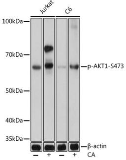 Western blot - Phospho-AKT1-S473 pAb (AP0637)