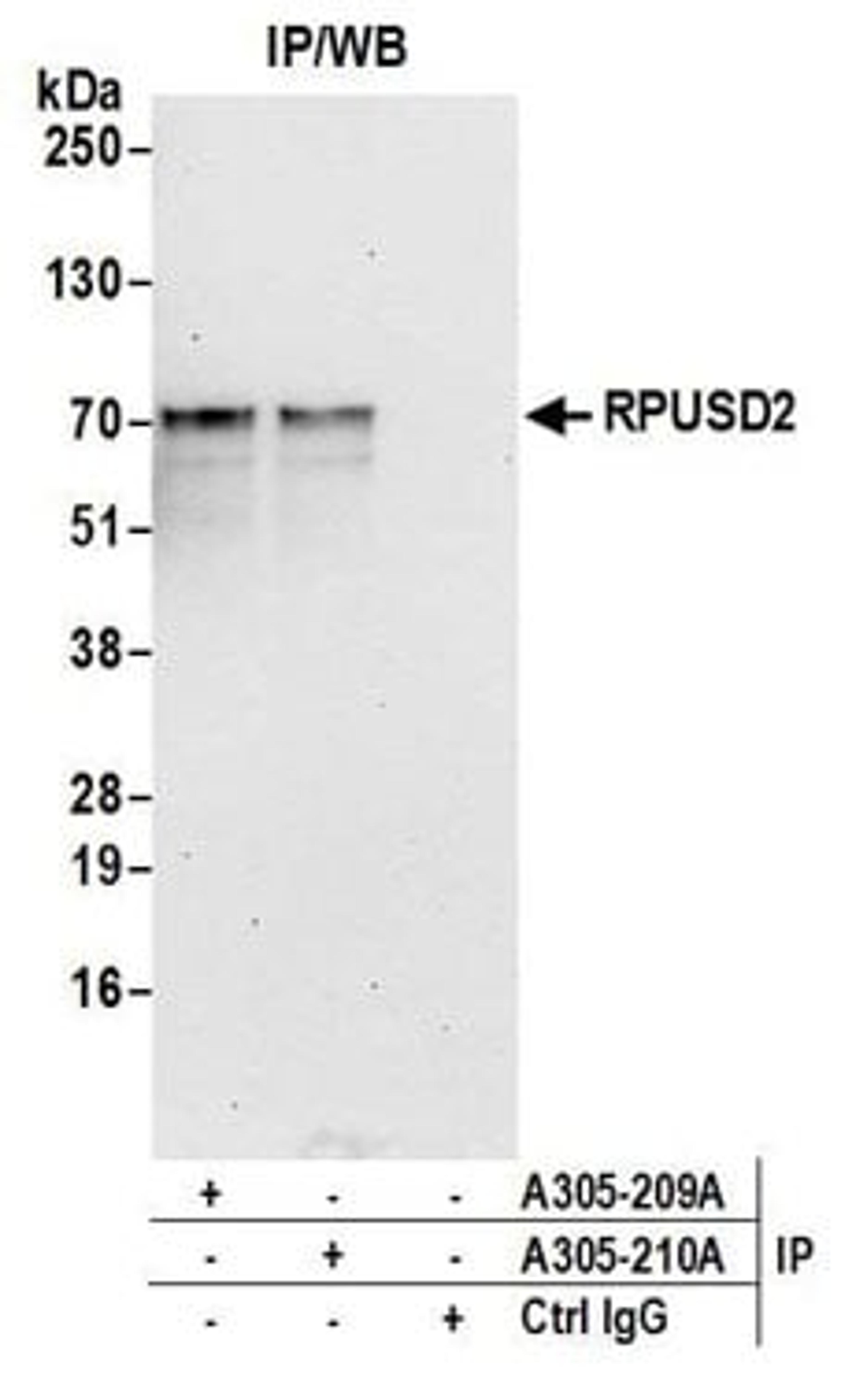 Detection of human RPUSD2 by western blot of immunoprecipitates.