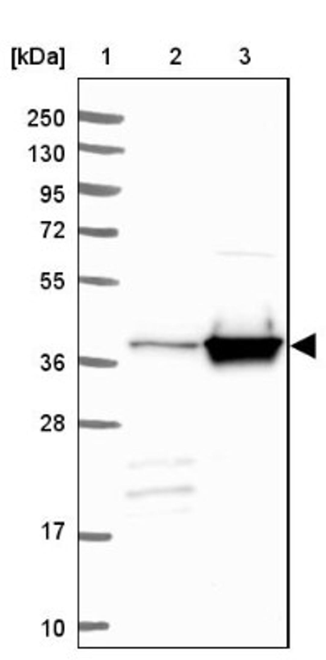 Western Blot: Acidic Calponin Antibody [NBP2-38643] - Lane 1: Marker [kDa] 250, 130, 95, 72, 55, 36, 28, 17, 10<br/>Lane 2: RT-4<br/>Lane 3: U-251 MG