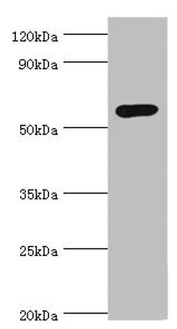 Western blot. All lanes: Glucokinase antibody at 8ug/ml + Jurkat whole cell lysate. Secondary. Goat polyclonal to rabbit IgG at 1/10000 dilution. Predicted band size: 52 kDa. Observed band size: 52 kDa. 