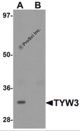 Western blot analysis of TYW3 in A549 cell lysate with TYW3 antibody at 1 μg/mL in (A) the absence and (B) the presence of blocking peptide.