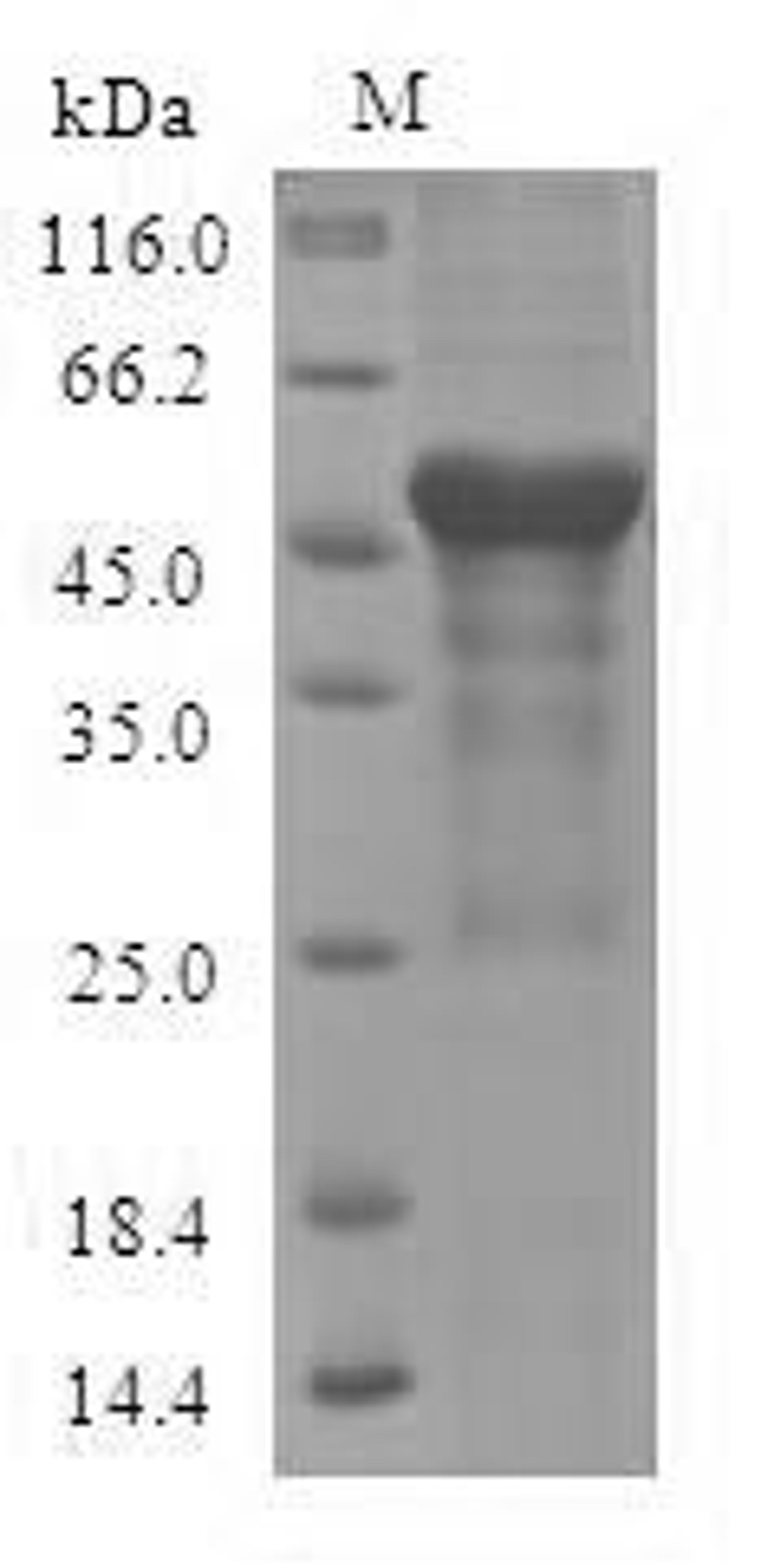 (Tris-Glycine gel) Discontinuous SDS-PAGE (reduced) with 5% enrichment gel and 15% separation gel.