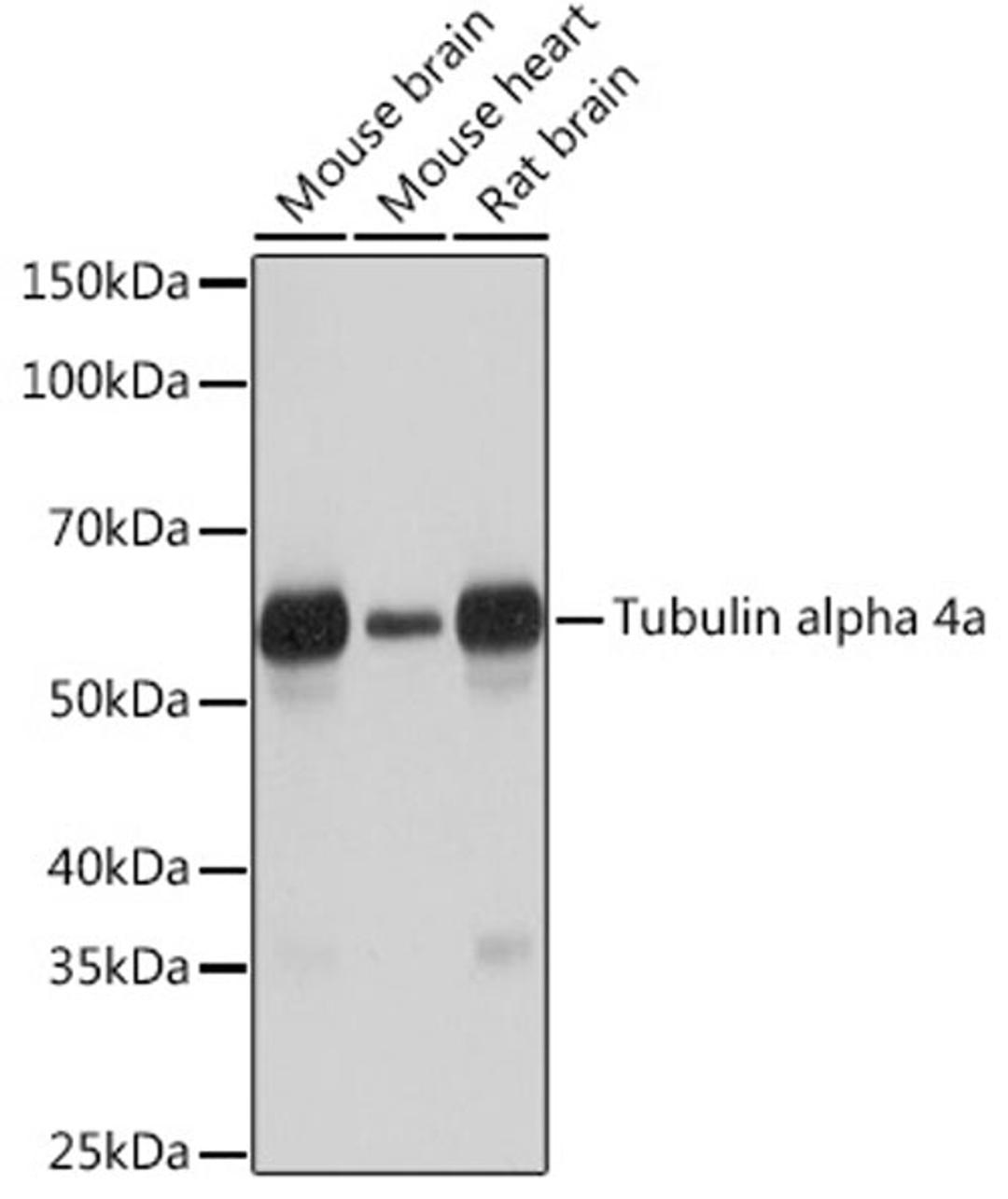 Western blot - Tubulin alpha 4a Rabbit mAb (A6830)