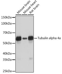 Western blot - Tubulin alpha 4a Rabbit mAb (A6830)