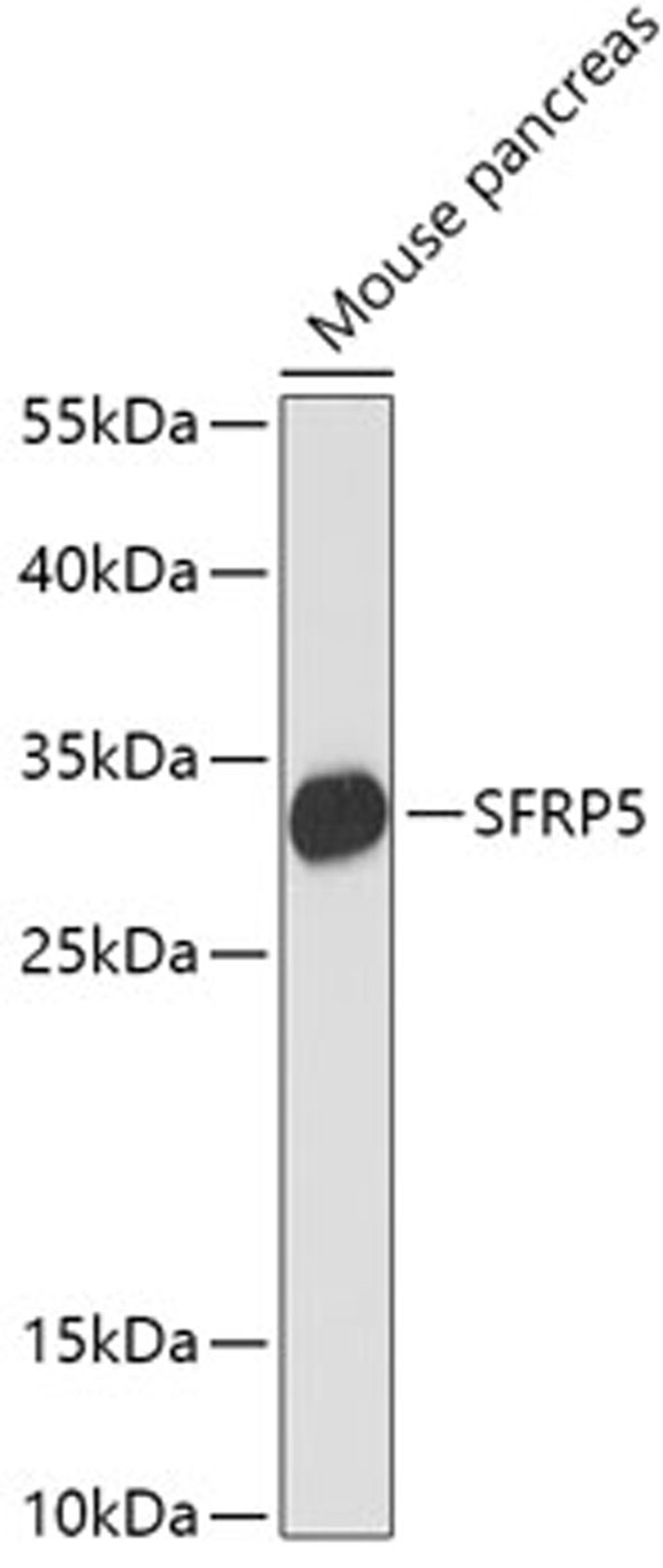 Western blot - SFRP5 antibody (A16734)