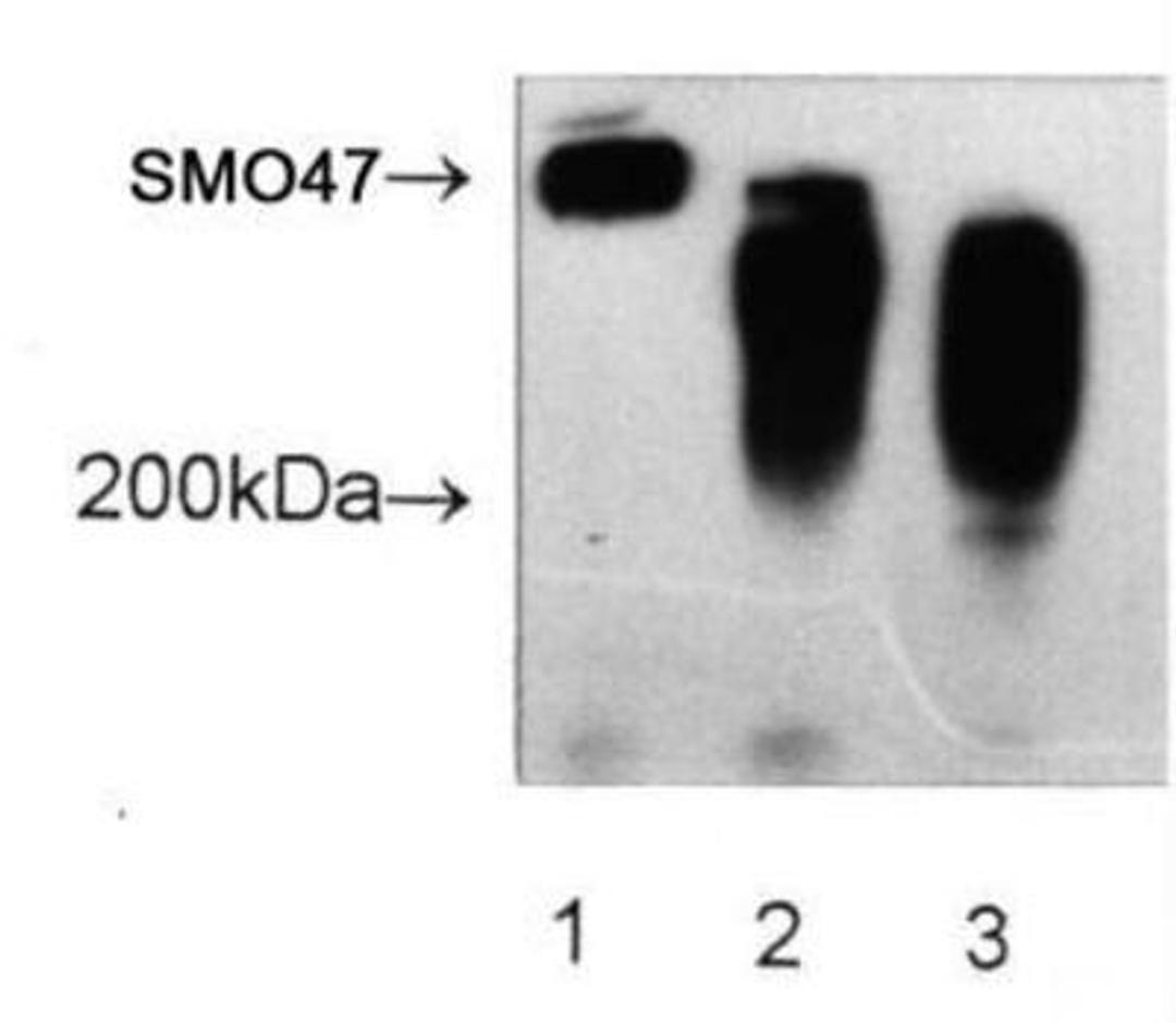 Western Blot: SM047 Antibody (SM047) [NBP1-97921] - SM047 immunoprecipitates immunoblotted with the SM047 antibody.  Lane 1) UWOV1 lysate, Lane 2) ovarian cancer patients serum and Lane 3) pooled normal serum.