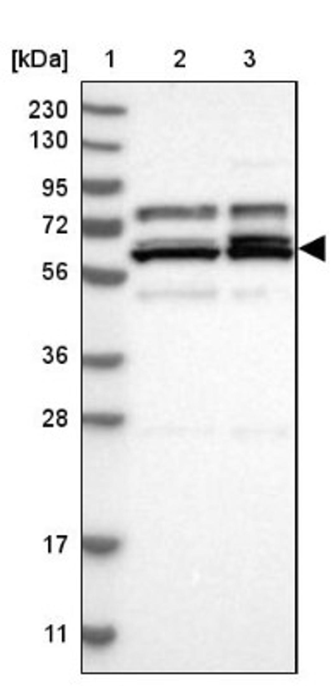 Western Blot: AARSD1 Antibody [NBP1-81145] - Lane 1: Marker [kDa] 230, 130, 95, 72, 56, 36, 28, 17, 11<br/>Lane 2: Human cell line RT-4<br/>Lane 3: Human cell line U-251MG sp