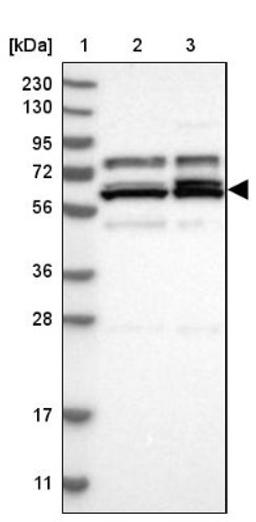 Western Blot: AARSD1 Antibody [NBP1-81145] - Lane 1: Marker [kDa] 230, 130, 95, 72, 56, 36, 28, 17, 11<br/>Lane 2: Human cell line RT-4<br/>Lane 3: Human cell line U-251MG sp