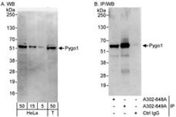 Detection of human Pygo1 by western blot and immunoprecipitation.