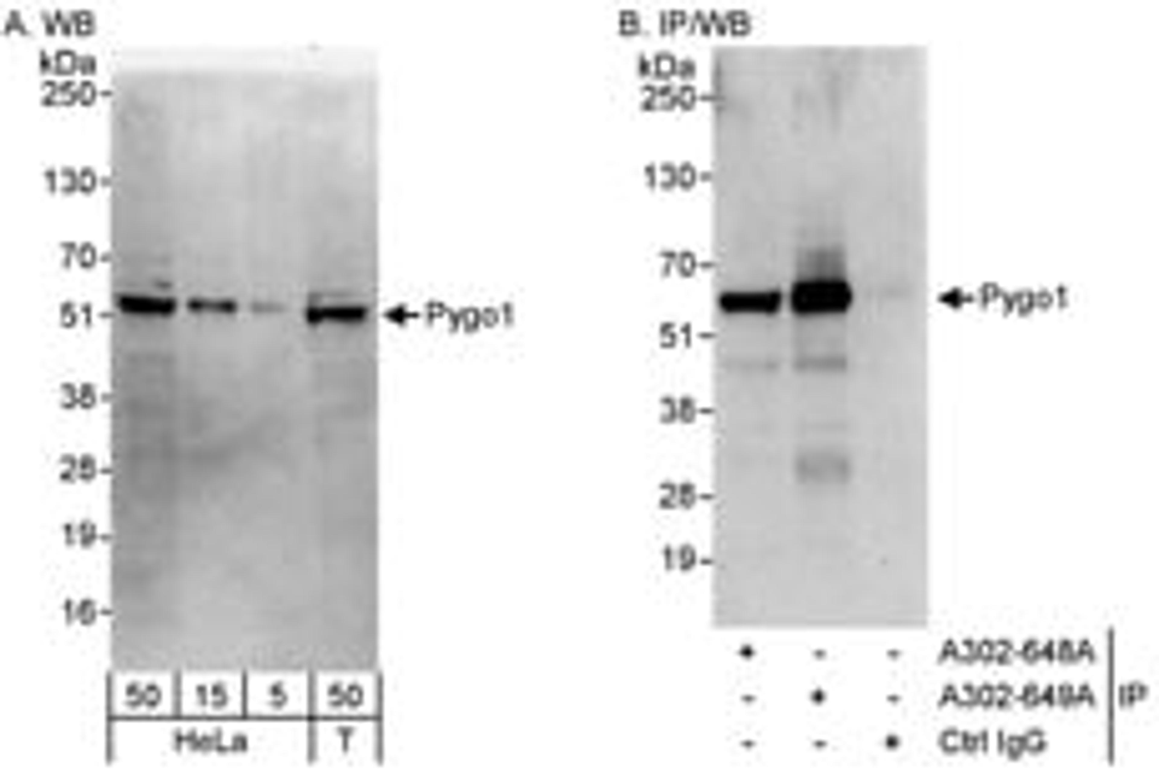 Detection of human Pygo1 by western blot and immunoprecipitation.