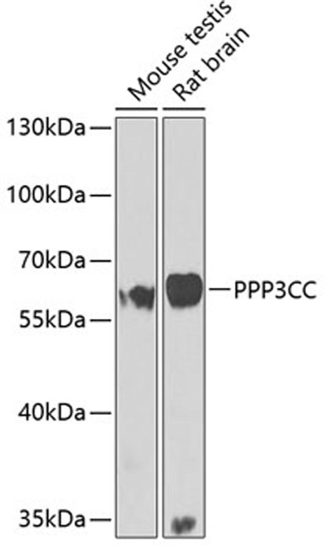 Western blot - PPP3CC antibody (A7714)