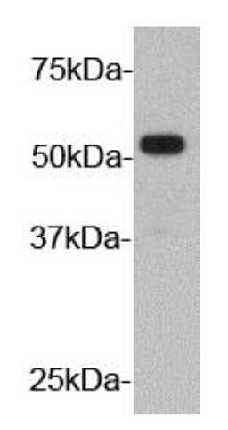 Western blot analysis of fusion protein lysate using HA Tag antibody (HRP)