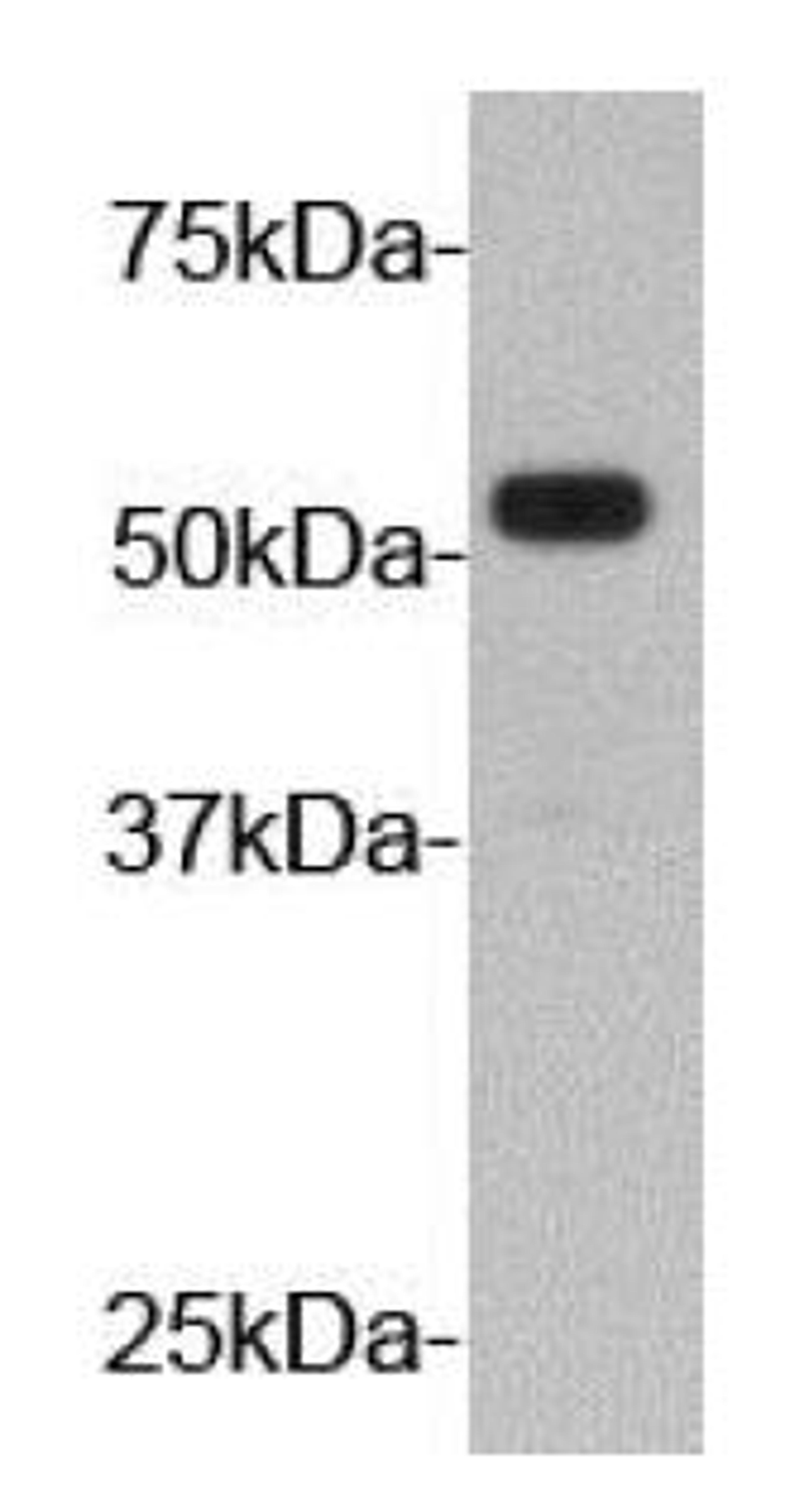 Western blot analysis of fusion protein lysate using HA Tag antibody (HRP)