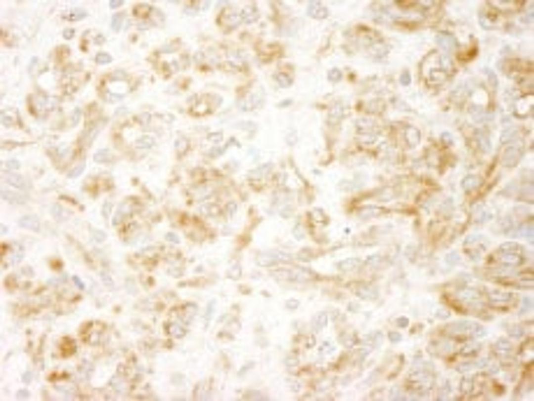 Detection of human ZAK by immunohistochemistry.