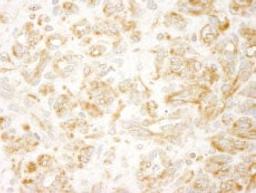 Detection of human ZAK by immunohistochemistry.