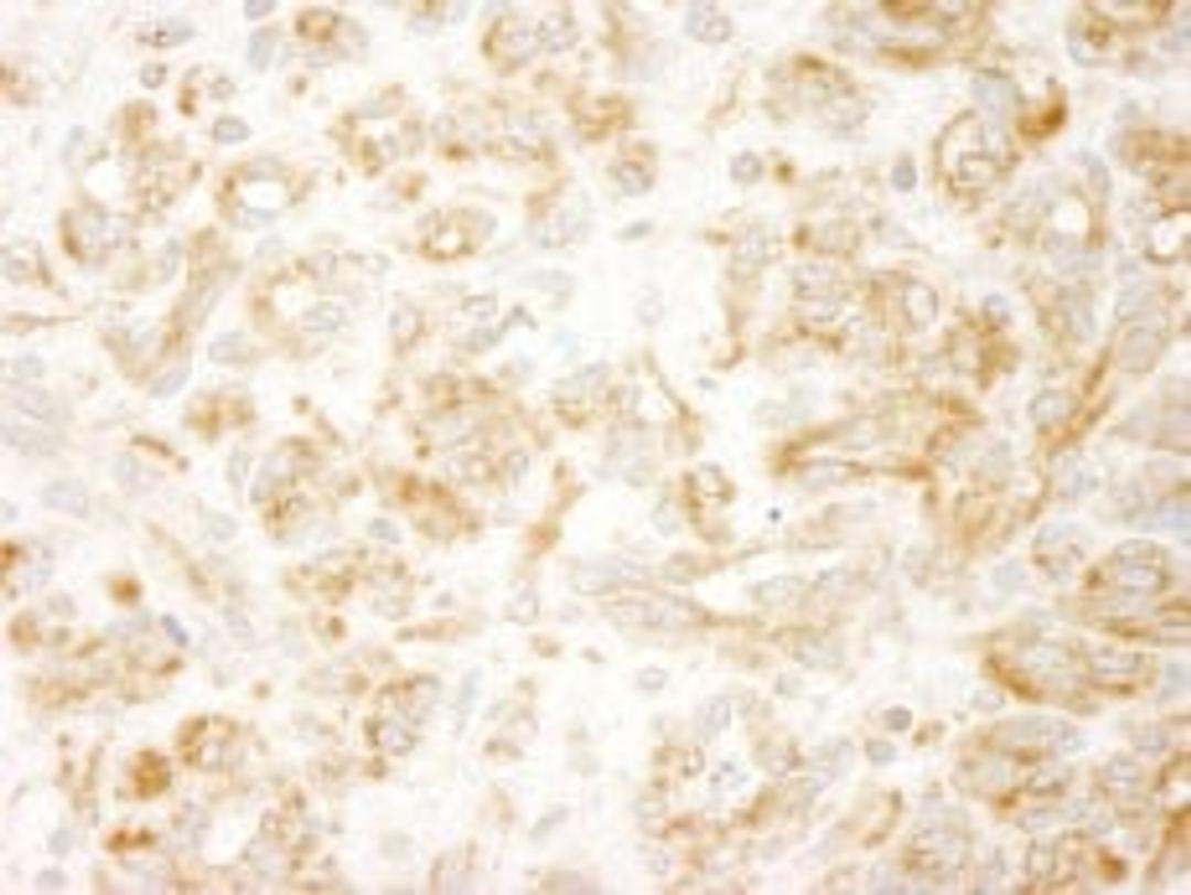 Detection of human ZAK by immunohistochemistry.