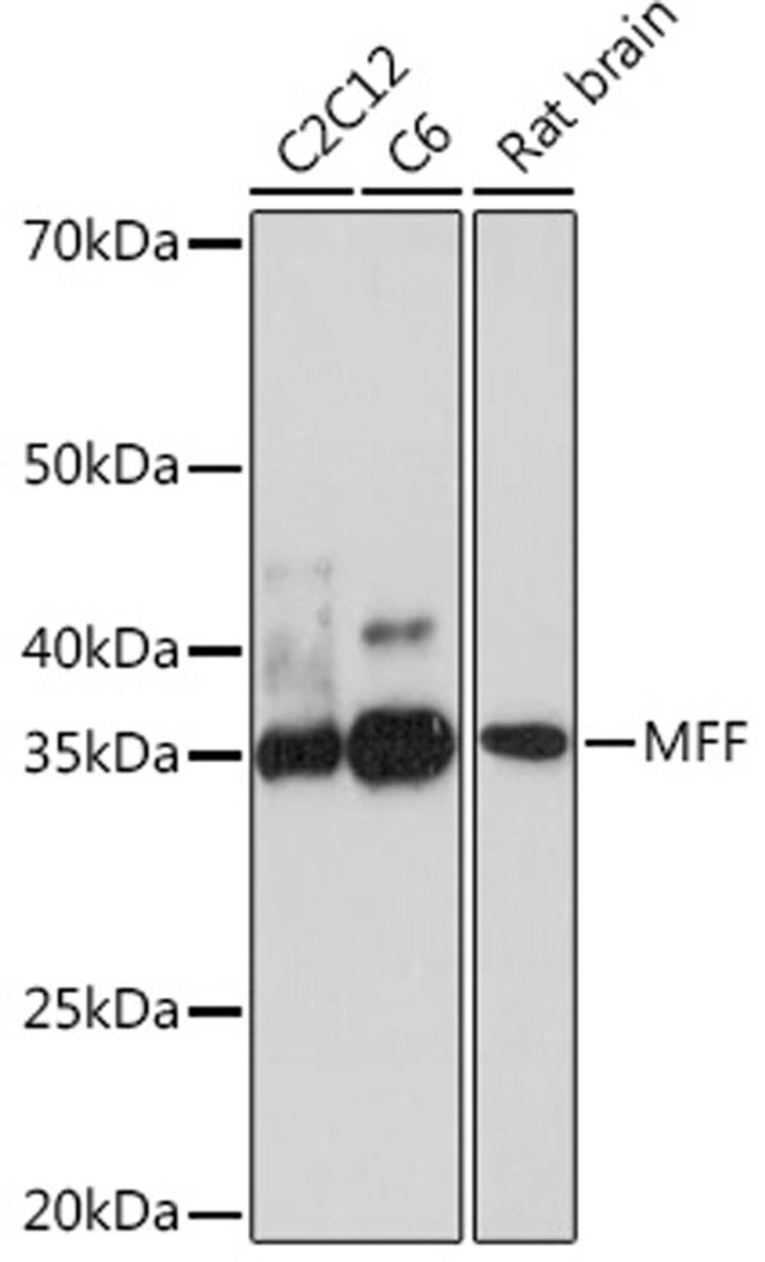 Western blot - MFF Rabbit mAb (A8700)