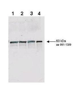 Western blot analysis of Lane 1 - non-phosphorylated wild type yeast Rad9, Lane 2 - in vitro phosphorylated wild type yeast Rad9, Lane 3 - non-phosphorylated S1129A/S1260A double mutant Rad9, Lane 4 - in vitro phosphorylated S1129A/S1260A double mutant us