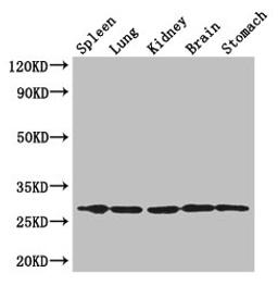 Western Blot. Positive WB detected in: Mouse spleen tissue, , Mouse lung tissue, Mouse kidney tissue, Mouse brain tissue, Mouse stomach tissue. All lanes: RTP3 antibody at 3µg/ml. Secondary. Goat polyclonal to rabbit IgG at 1/50000 dilution. Predicted band size: 28 kDa. Observed band size: 28 kDa