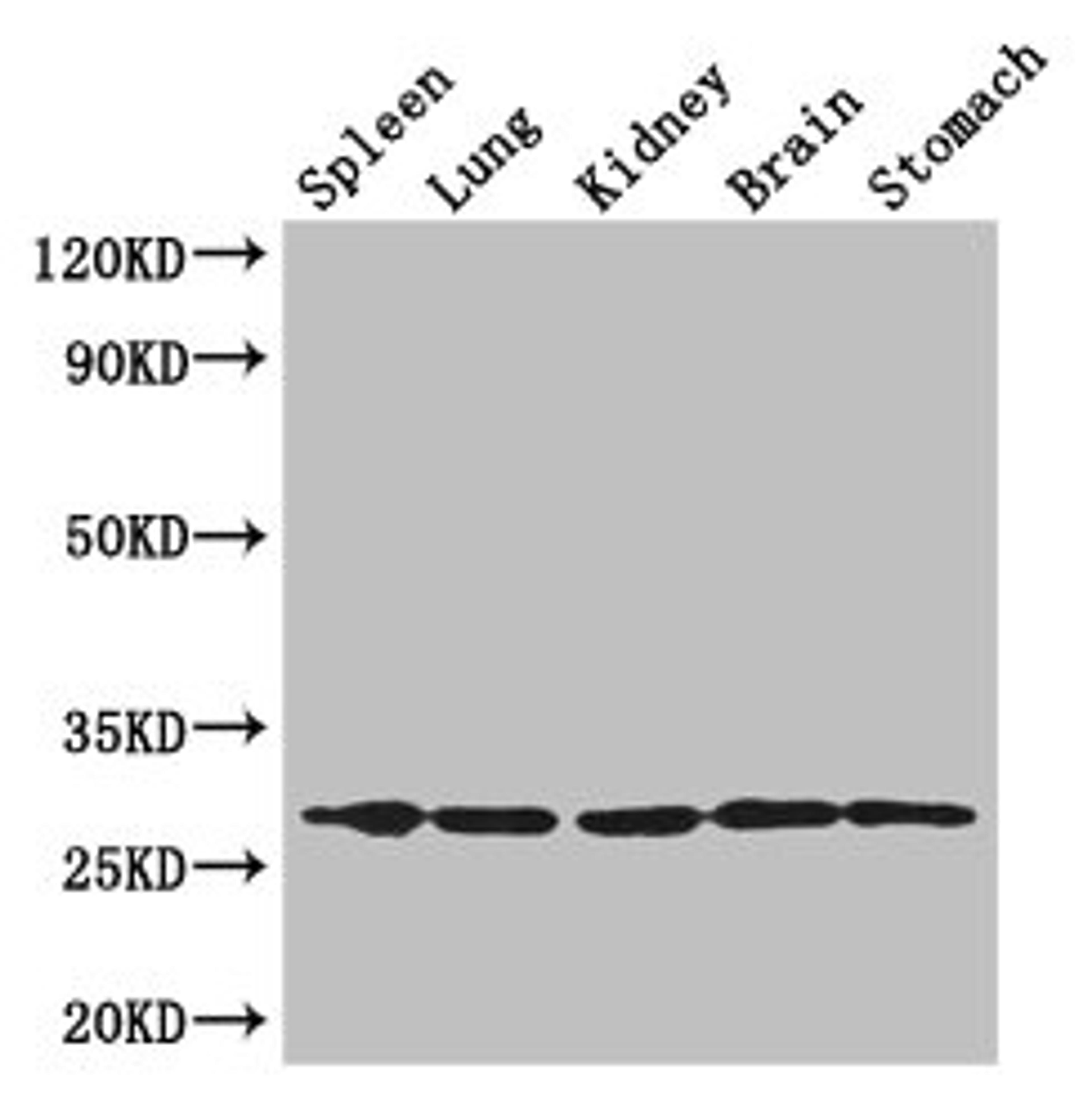 Western Blot. Positive WB detected in: Mouse spleen tissue, , Mouse lung tissue, Mouse kidney tissue, Mouse brain tissue, Mouse stomach tissue. All lanes: RTP3 antibody at 3µg/ml. Secondary. Goat polyclonal to rabbit IgG at 1/50000 dilution. Predicted band size: 28 kDa. Observed band size: 28 kDa