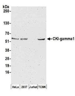 Detection of human and mouse CKI-gamma1 by western blot.