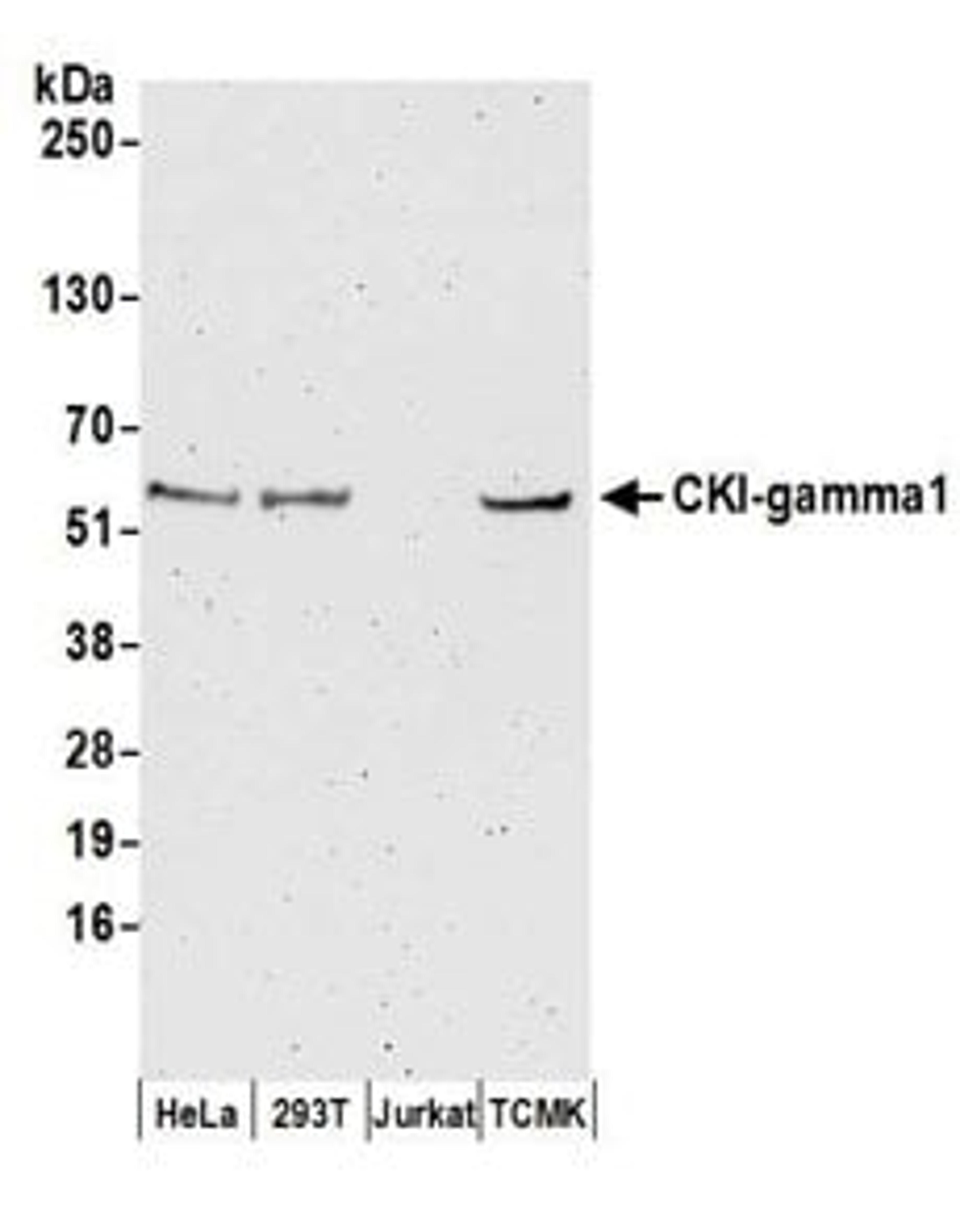 Detection of human and mouse CKI-gamma1 by western blot.