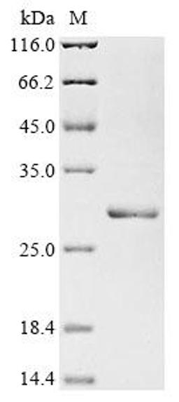 (Tris-Glycine gel) Discontinuous SDS-PAGE (reduced) with 5% enrichment gel and 15% separation gel.