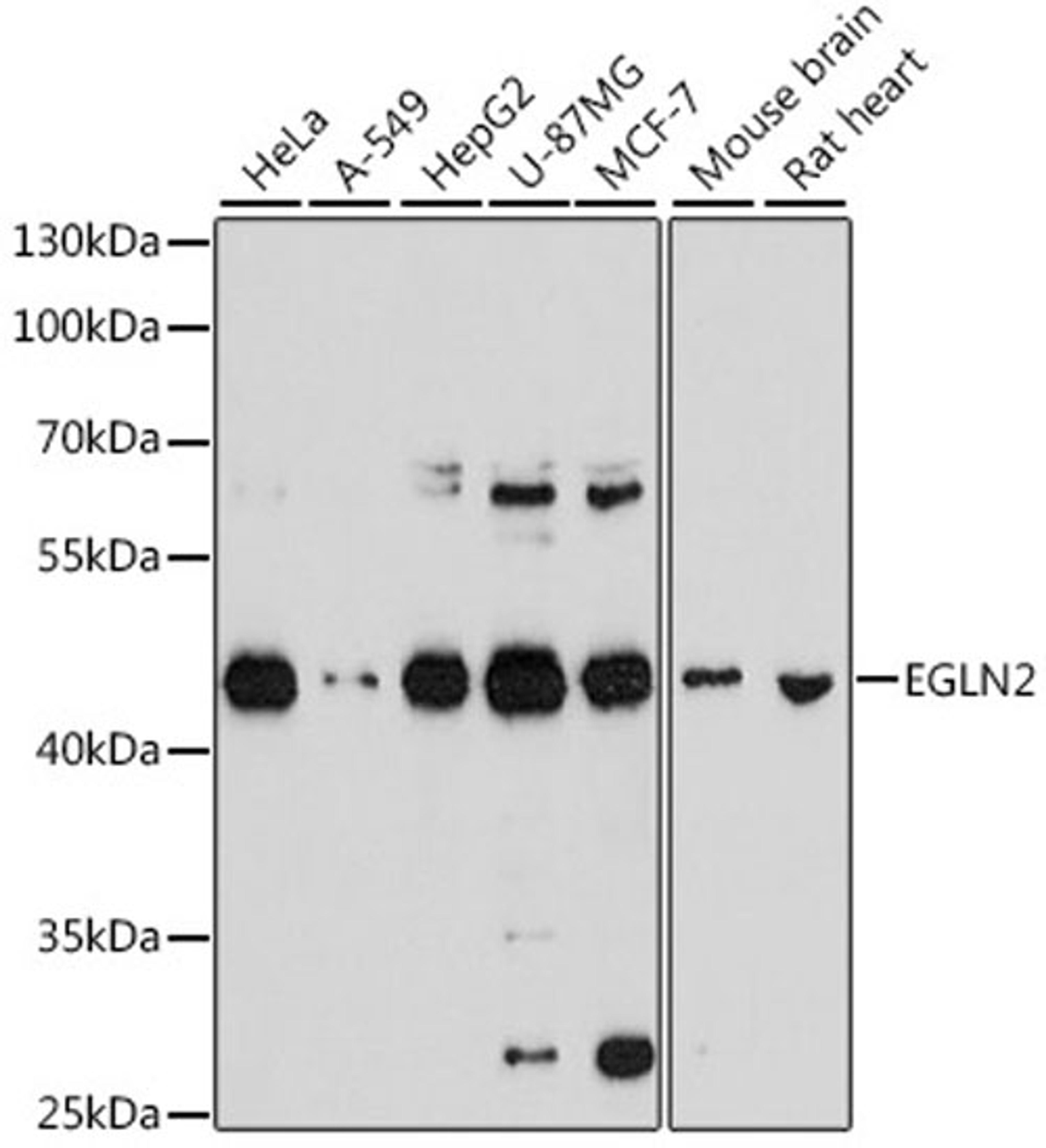 Western blot - EGLN2 antibody (A2252)