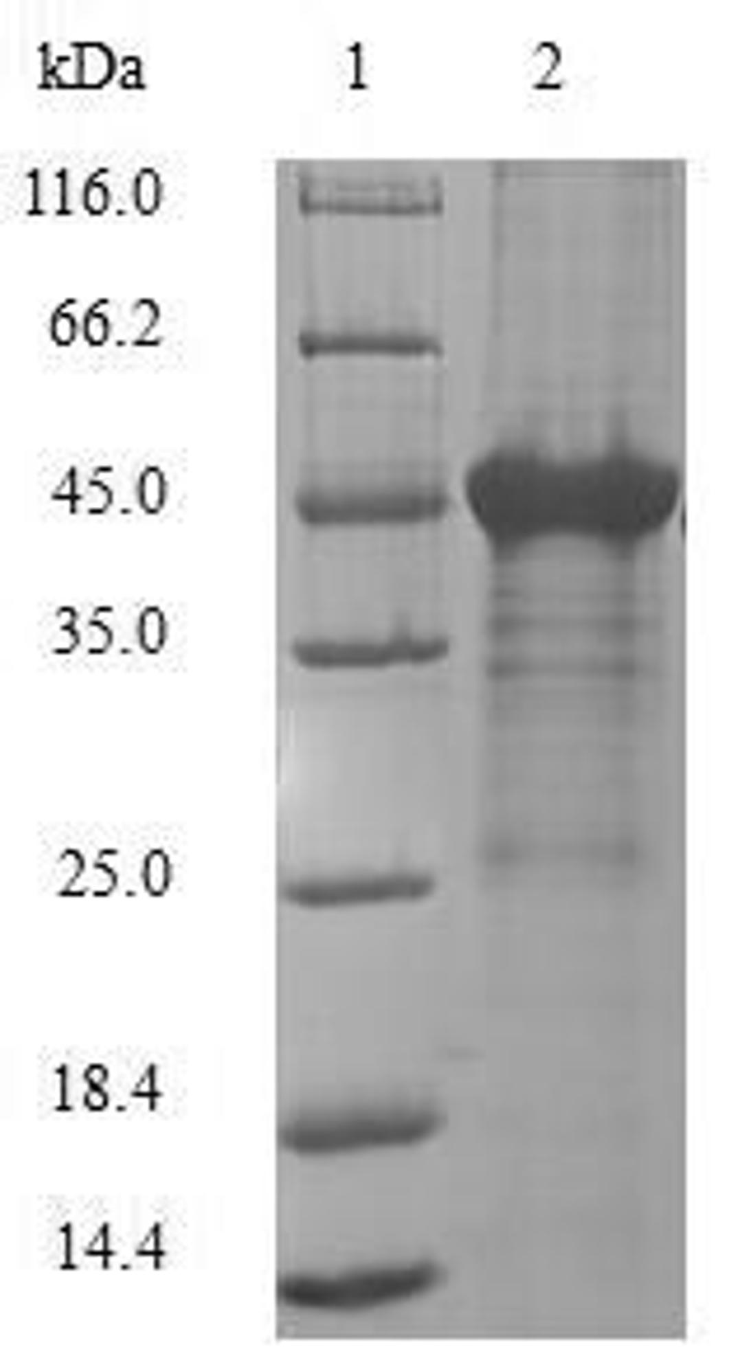 (Tris-Glycine gel) Discontinuous SDS-PAGE (reduced) with 5% enrichment gel and 15% separation gel.